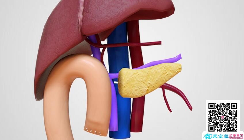 胰腺癌根治術(shù)動畫視頻