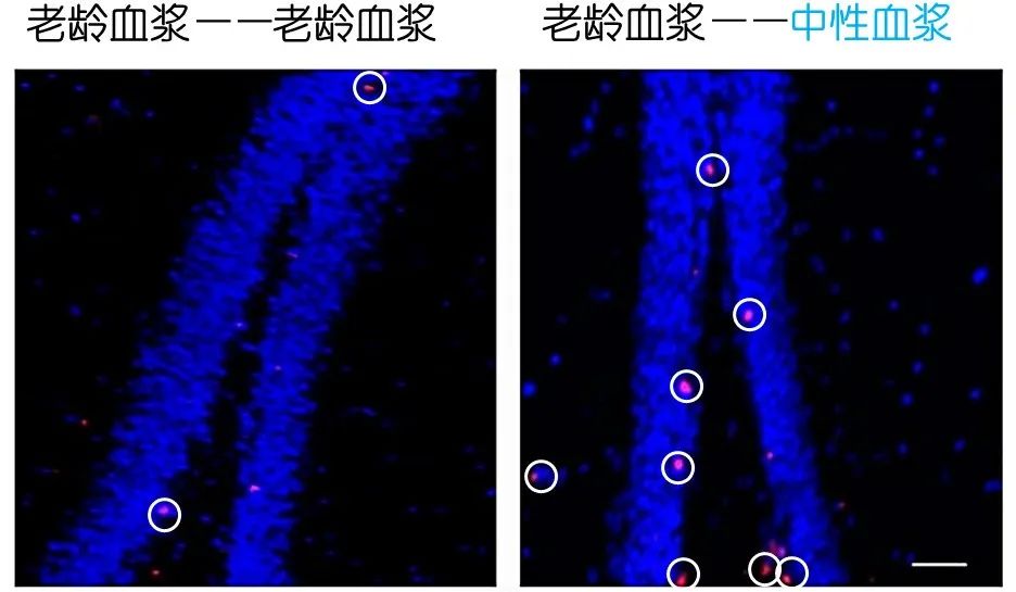 重返年輕不用大換血，只要給血液“兌點(diǎn)水”？