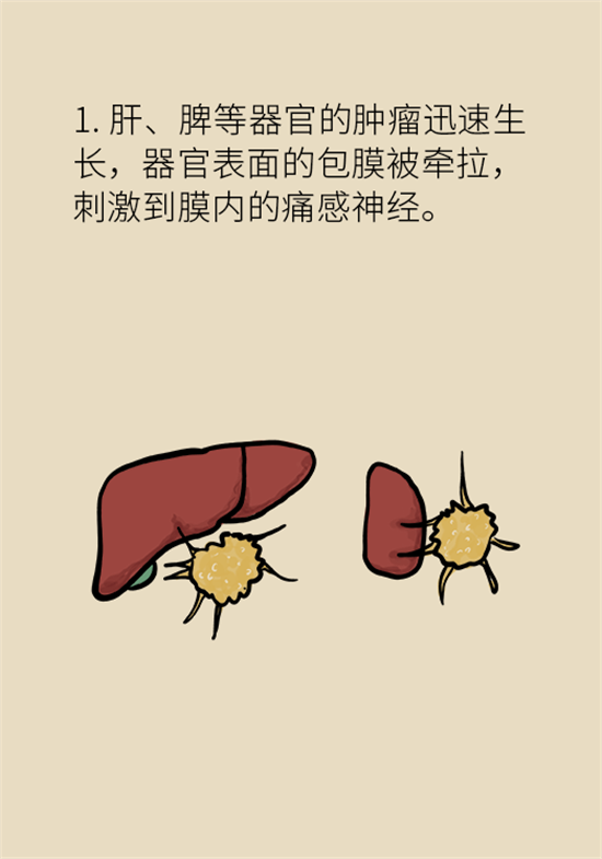 癌癥到底有多痛？需要注意這7個重點問題