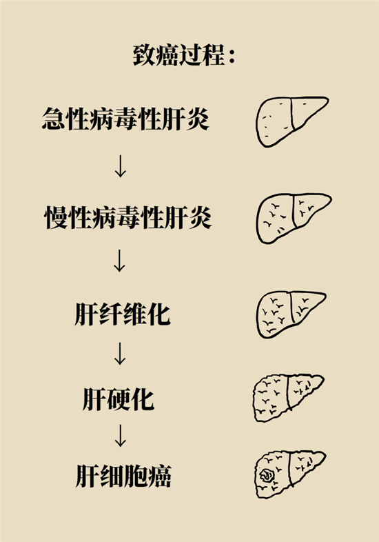 癌癥會(huì)傳染嗎？專(zhuān)家：這些高危因素得注意