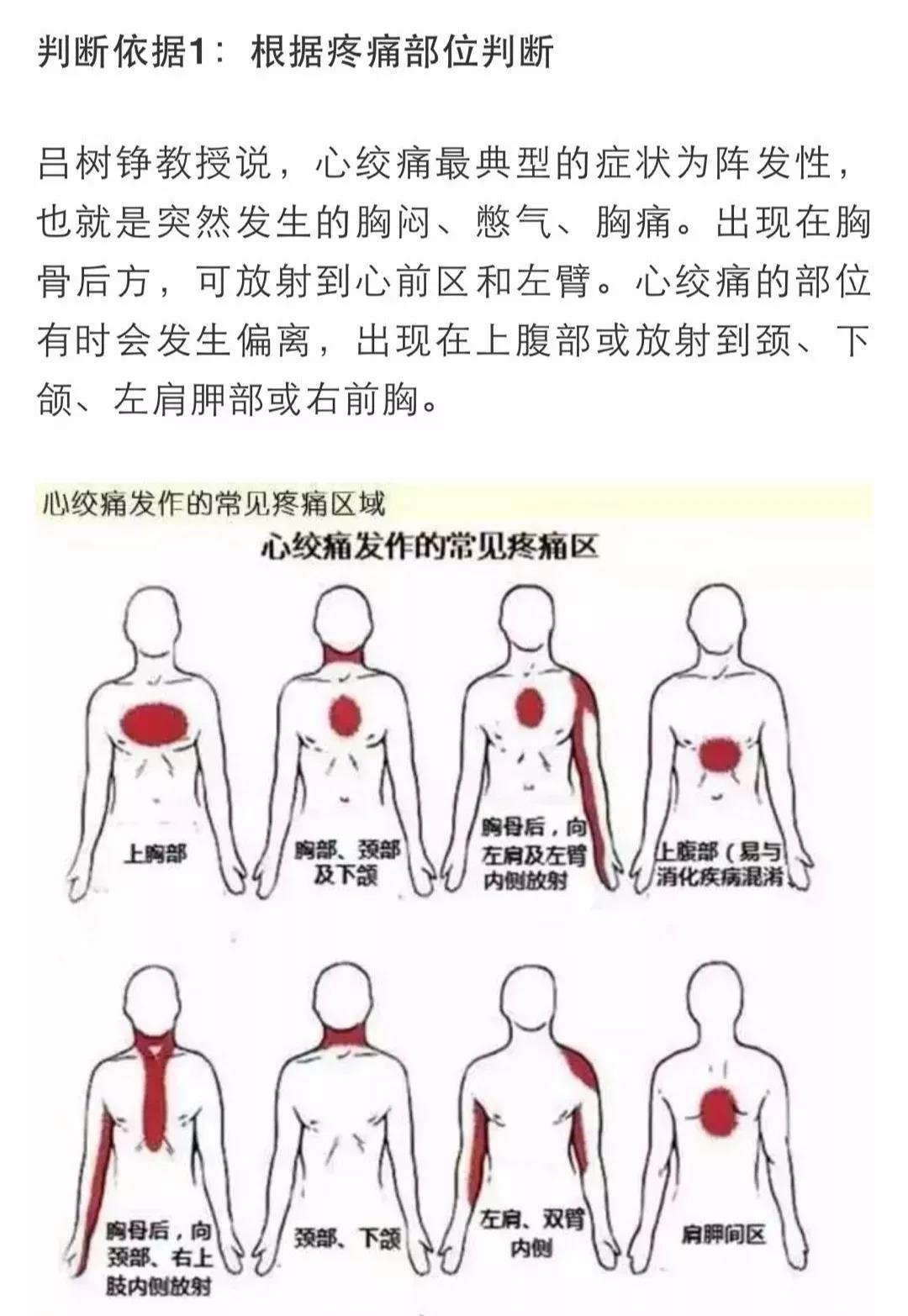 心梗有前兆！心臟發(fā)出的警報你在意了嗎？