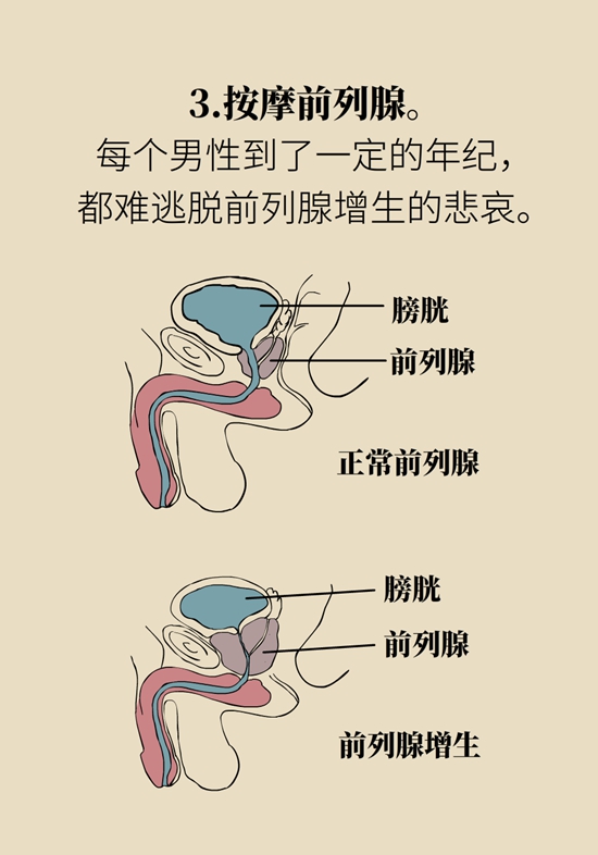 怎么做可以預(yù)防痔瘡呢？按摩前列腺、鍛煉盆底肌