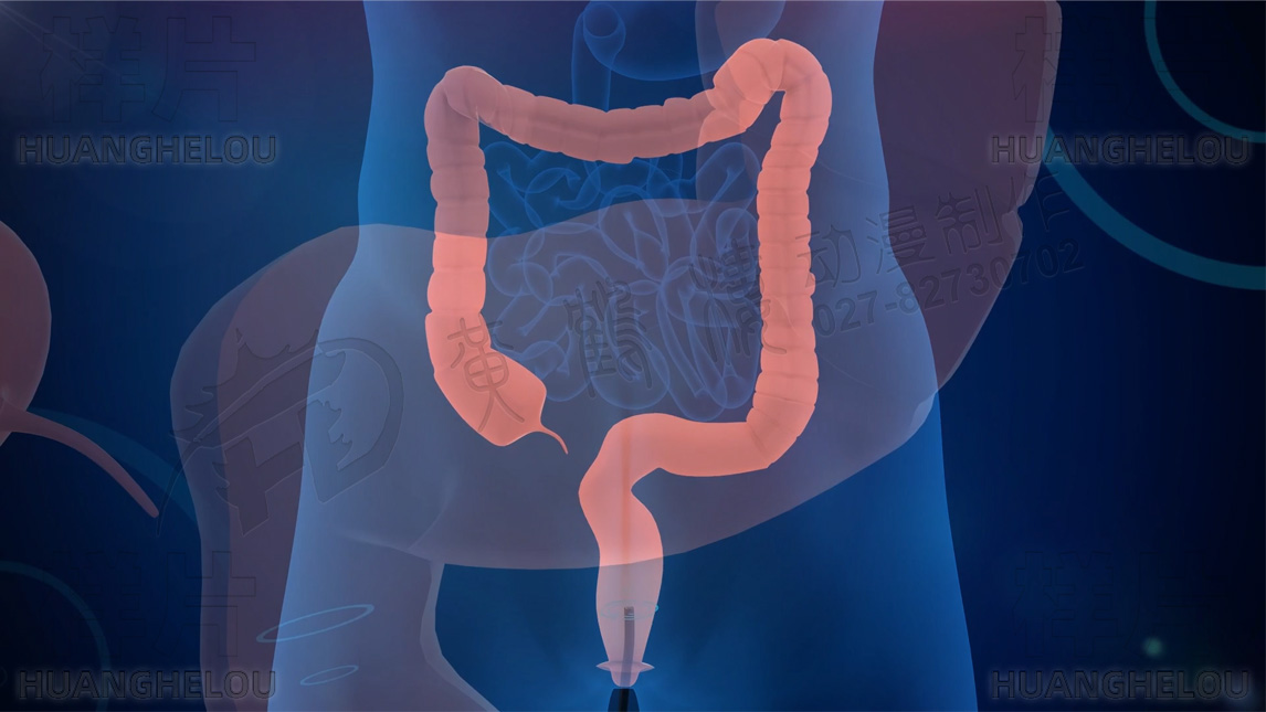 《一次性磁導航定位電子結(jié)腸鏡機器人》三維醫(yī)療器械工作原理演示動畫制作